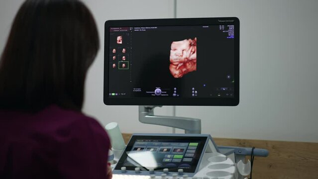Sonographer performing ultrasound check to a pregnant woman. Specialist looking at the equipment screen with a picture of unborn baby in mom’s belly.