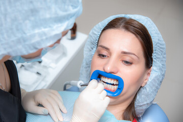 Preparing the oral cavity for whitening with an ultraviolet lamp. Close-up