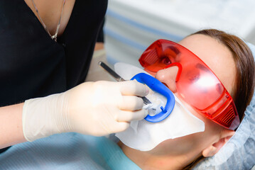 Preparing the oral cavity for whitening with an ultraviolet lamp. Close-up
