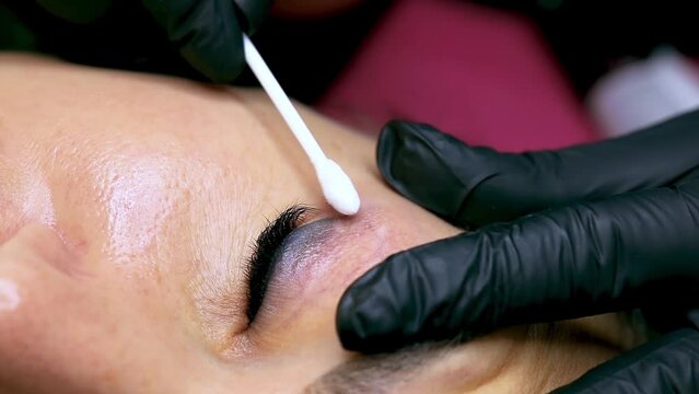 rubbing the tattoo removal compound over the surface of the traumatized eyelid. removing old permanent eyelid makeup