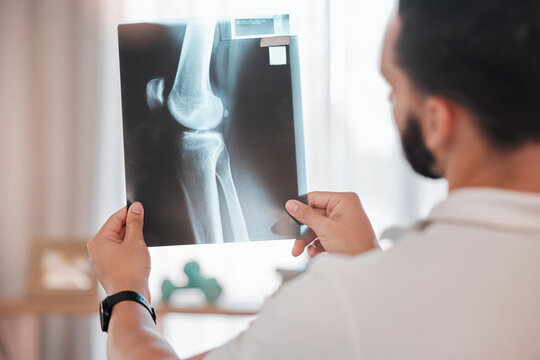Health, x ray and physiotherapy, man physiotherapist check medical results from injury, broken bone and healthcare. Physio, wellness and medicine, rehabilitation in health care and xray scan.