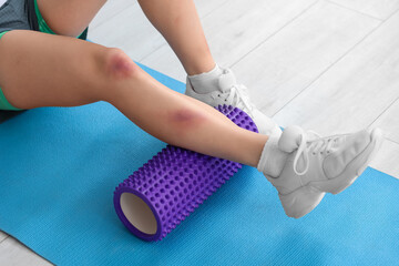 Sporty young woman with bruised leg and foam roller training in gym