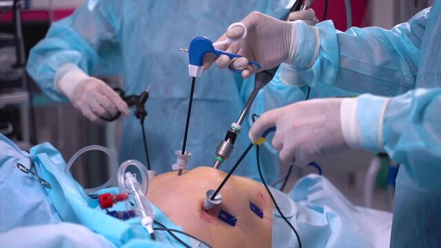 Close up ands of surgeons during operation with surgical laparoscopy instruments