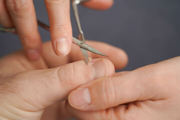 Men's manicure at home. Cut fingernails. Fingernails close-up. Untrimmed nails, burrs on the...