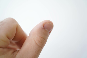 Men's manicure at home. Cut fingernails. Fingernails close-up. Untrimmed nails, burrs on the...
