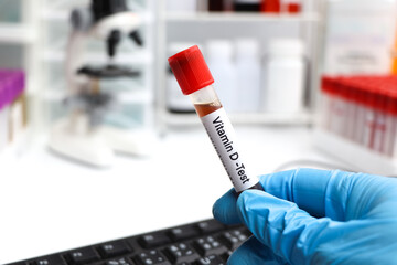 Blood samples for testing vitamin D in the laboratory