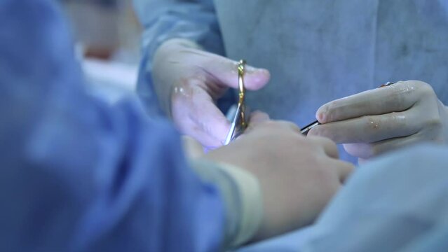 Team of doctors and surgeons processing surgical operation in operating room modern hospital emergency department. Close-up of doctors hands. Plastic surgery.
