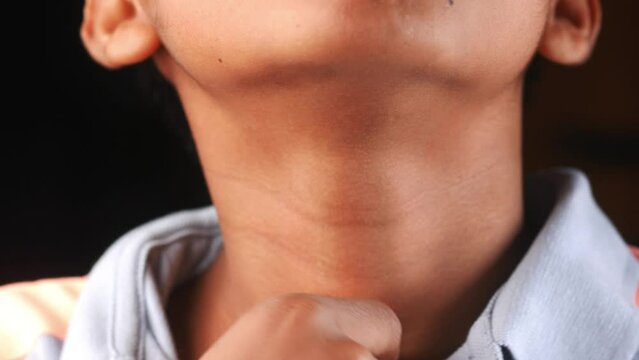 boy suffering throat pain close up 