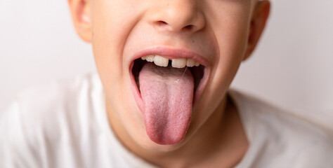 Close-up smile of a little happy child of 8 years old who shows the tongue