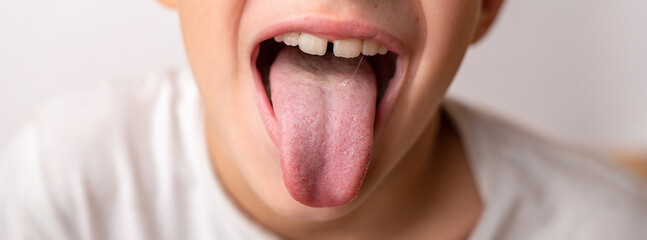 Close-up smile of a little happy child of 8 years old who shows the tongue
