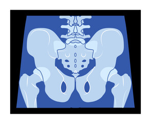 X-Ray pelvis Skeleton Hip Human body Bones adult people roentgen back view. 3D realistic flat blue color concept Vector illustration of medical anatomy isolated on black background