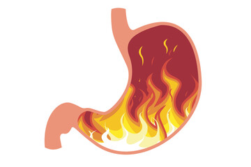 Stomach ache vector. Diseases of the human stomach. Human stomach vector. Illustration of the human digestive system
