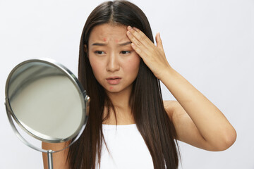 Asian woman with mirror in hand facial skin problems, acne and inflammation, red rash and...
