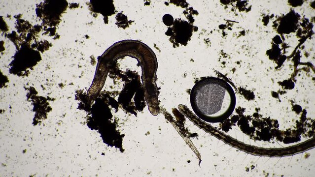microorganisms and soil biology, with nematodes and fungi under the microscope. in a soil and compost sample
