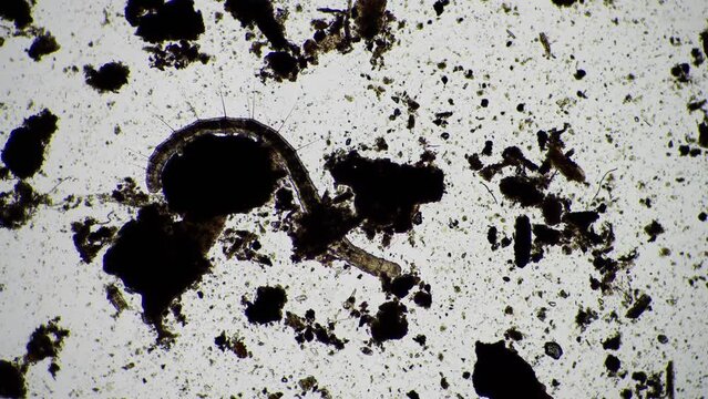 human parasite. gut intestinal infection disease. microorganism infection in hospital 