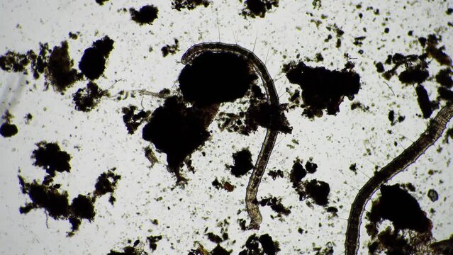 human parasite. gut intestinal infection disease. microorganism infection in hospital 