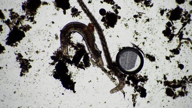 human parasite. gut intestinal infection disease. microorganism infection in hospital 