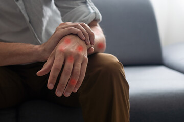 red spots on the hands