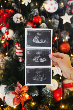 Image of an ultrasound scan of pregnancy collage of three on the background of a Christmas tree. Ultrasound scan. Beautiful christmas tree decorated with beautiful red and white shiny baubles