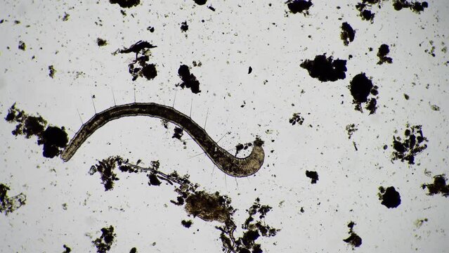 soil microorganisms in a sample with soil worm parasites