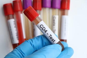 CD4 test to look for abnormalities from blood