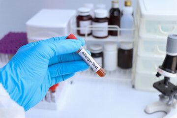Allergy test to look for abnormalities from blood