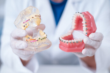 doctor orthodontist shows how the system of braces on teeth is arranged