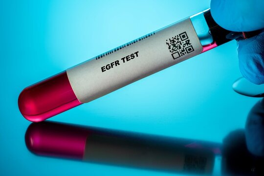 Egfr Test Blood Tests for Older Adults. Recommended Blood Test for the Elderly