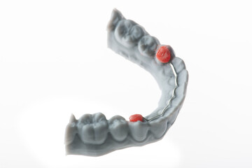 kieferorthopädische Behandlung in der Zahnarztpraxis, festsitzender Retainer auf Kunststoffmodell, weißer Untergrund, freigestellt.