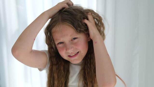 The child scratches his head with a rash. Itching from chickenpox in a girl.