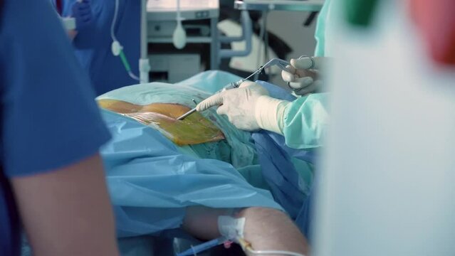 Neurosurgical operation to remove a hernia on the spine. Hands of a surgeon in medical gloves with an instrument. Patient on the operating table.
