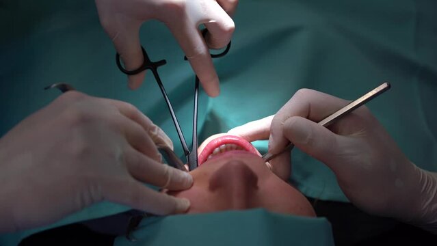 Dentists checking a female patient's mouth 4k