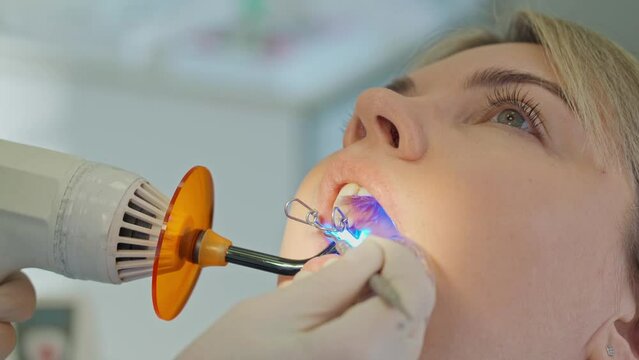close-up of a dentist polymerizes a filling with a special lamp in the mouth of a young woman, a dentist at work. the patient in the dentist's chair treats teeth.