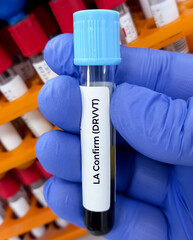 Scientist holding blood sample for LA(Lupus Anticoagulant) confirm test. dRVVT test, laboratory testing concept.
