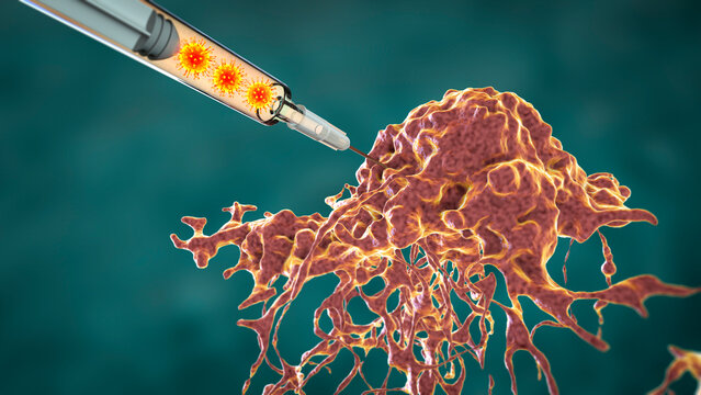 Oncolytic viral therapy, conceptual illustration