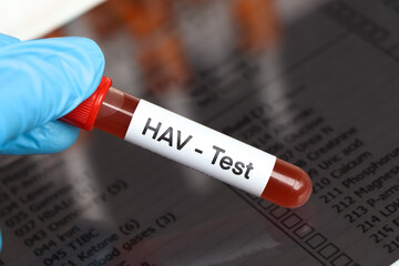 HAV Test to look for abnormalities from blood