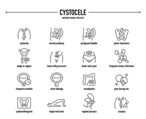Cystocele, Anterior Vaginal Prolapse symptoms, diagnostic and treatment vector icon set. Line editable medical icons. - obrazy, fototapety, plakaty