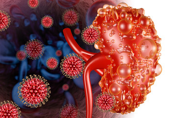 Virus infection of kidney. Kidney disease. 3d illustration