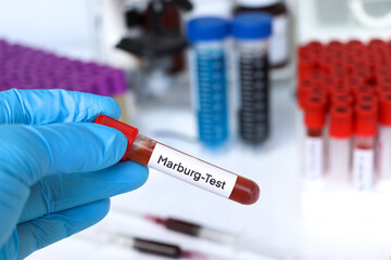 Marburg test to look for abnormalities from blood