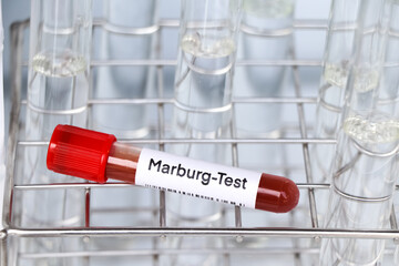 Marburg test to look for abnormalities from blood