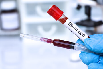 Stem cell test to look for abnormalities from blood