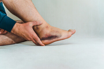 Sprained and swollen ankle.Man hold his sprained ankle at home. Ankle sprain. Injury.White,gray...