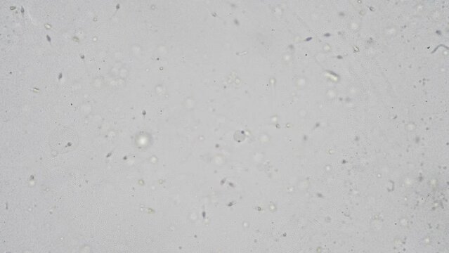 The Microscopic World. Sperm under the microscope.