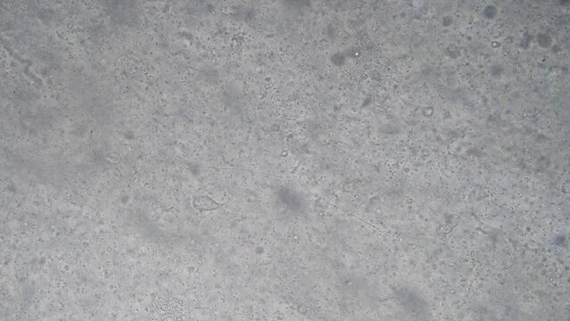 The Microscopic World. Sperm under the microscope.