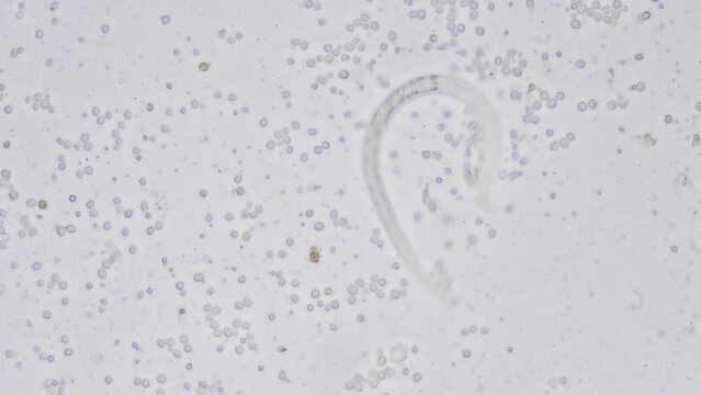 The Microscopic World. Nematode or roundworm.