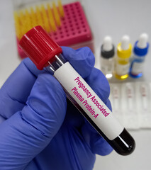 Blood sample for Pregnancy-associated plasma protein-A(PAPP-A) test, first-trimester screening test.