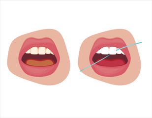 Tooth Needle Illustration, Healthy Teeth, Dentist  Vector Illustration, Oral Care