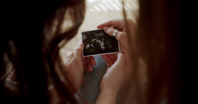 Happiness of motherhood, Lesbians waiting for baby Embracing and looking at ultrasound picture. Embrace and holding each other. Women Lgbt Couple rest at home. Love LGBTQI. LGBT rights,