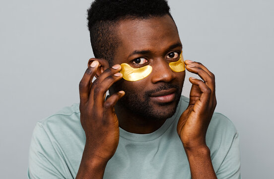 Golden patches under the eyes