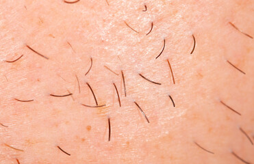Fototapeta premium Hair on the skin of a man's face. Macro